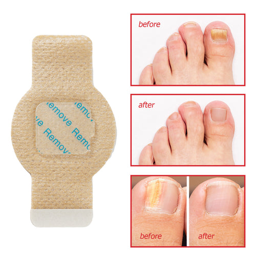 Overnight Nail Patches