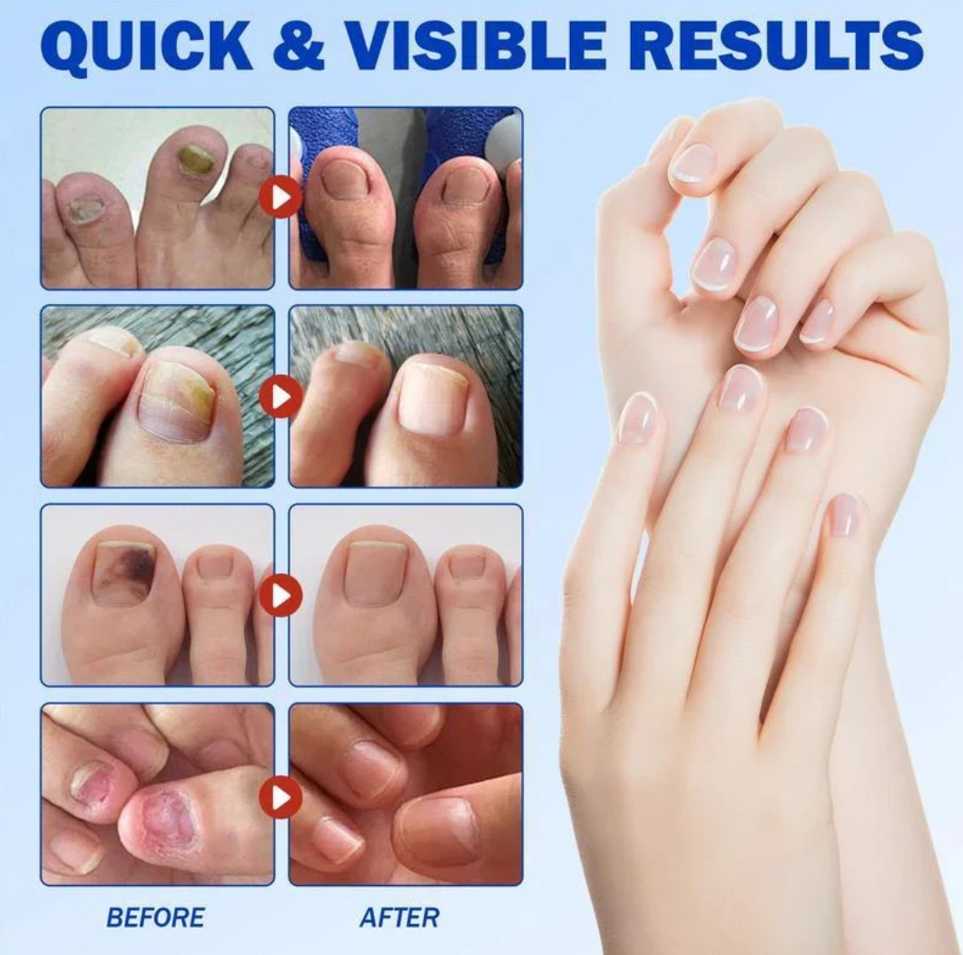 Overnight Nail Patches